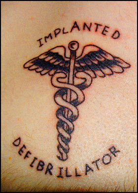 Татуировки по медицинским показаниям (16 фото)
