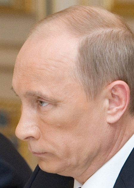 Синяк на лице Путина (7 фото)