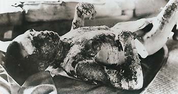 Хиросима и последствия бомбёжки (32 фото)