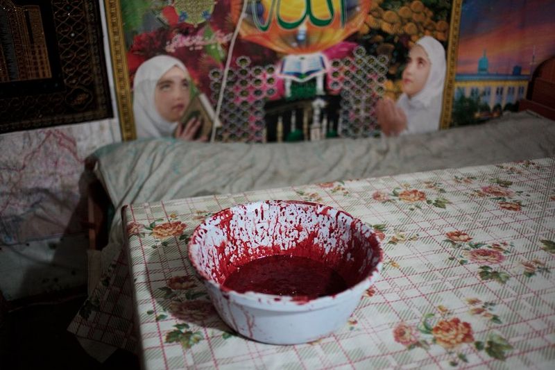 Лечение кровью в Казахстане (18 фото)