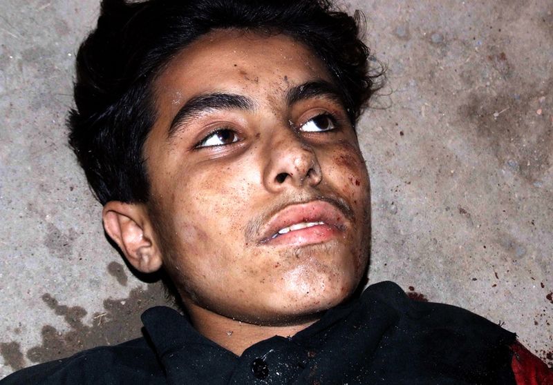14-летний Умар Фидаи – террорист-смертник, чей жилет взорвался только наполовину – ждет отправления в больнице у храма недалеко от Дера Гхази Кхан 3 апреля. Смертники «Талибана» напали на самые важные храмы суфийских мусульман, убив 42 человека и ранив более 100, на годовщине смерти его основателя. Позднее Фидаи пришел в себя, пожалел о содеянном и попросил прощения. Он также заявил, что его нанял «Талибан», тренировка длилась полгода, вместе с ним были еще 300 рекрутов. (AP Photo/Saleem Raza Khan)