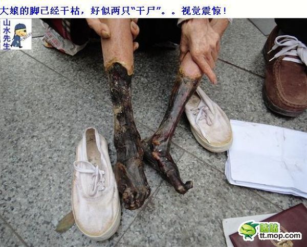 Женщина с отсохшими ногами просит милостыню (9 фото)