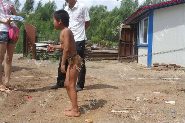 Слабоумного мальчика держат на цепи (7 фото)