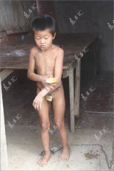 Слабоумного мальчика держат на цепи (7 фото)