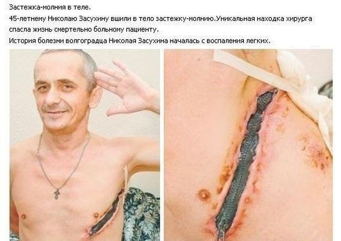 Русский хирург - креативщик (1 фото)