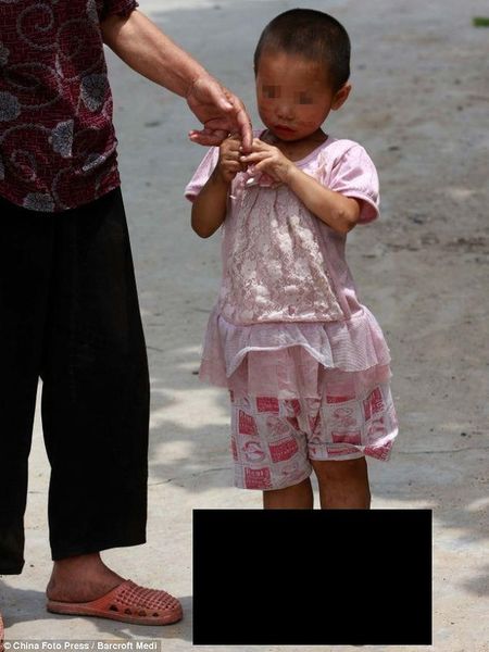 Девочка не может носить обувь (6 фото)