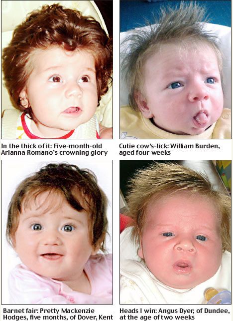 Самые волосатые новорожденные (6 фото)