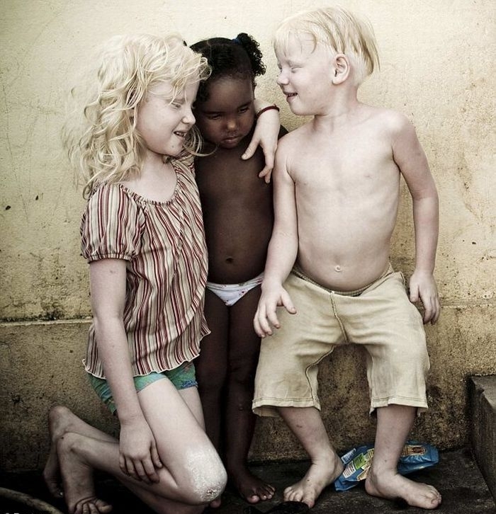 В семье темнокожих бразильцев родилось трое альбиносов (4 фото)